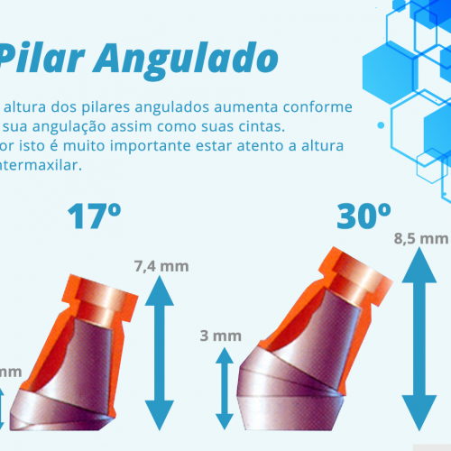 Pilar-angulado